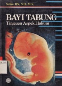 Bayi Tabung ; Tinjauan Aspek Hukum.